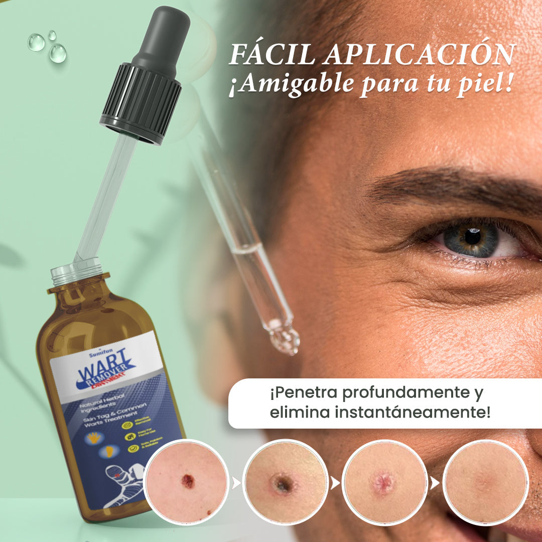 REMOVEDOR DE VERRUGAS Y MANCHAS - ACCION RAPIDA Y EFECTIVA