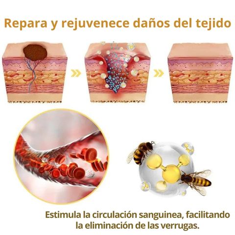 DERMABEE - TRATAMIENTO CON VENENO DE ABEJA PARA VERRUGAS Y MANCHAS